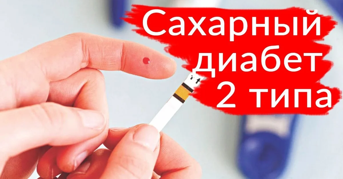 Сахарный диабет 2 типа